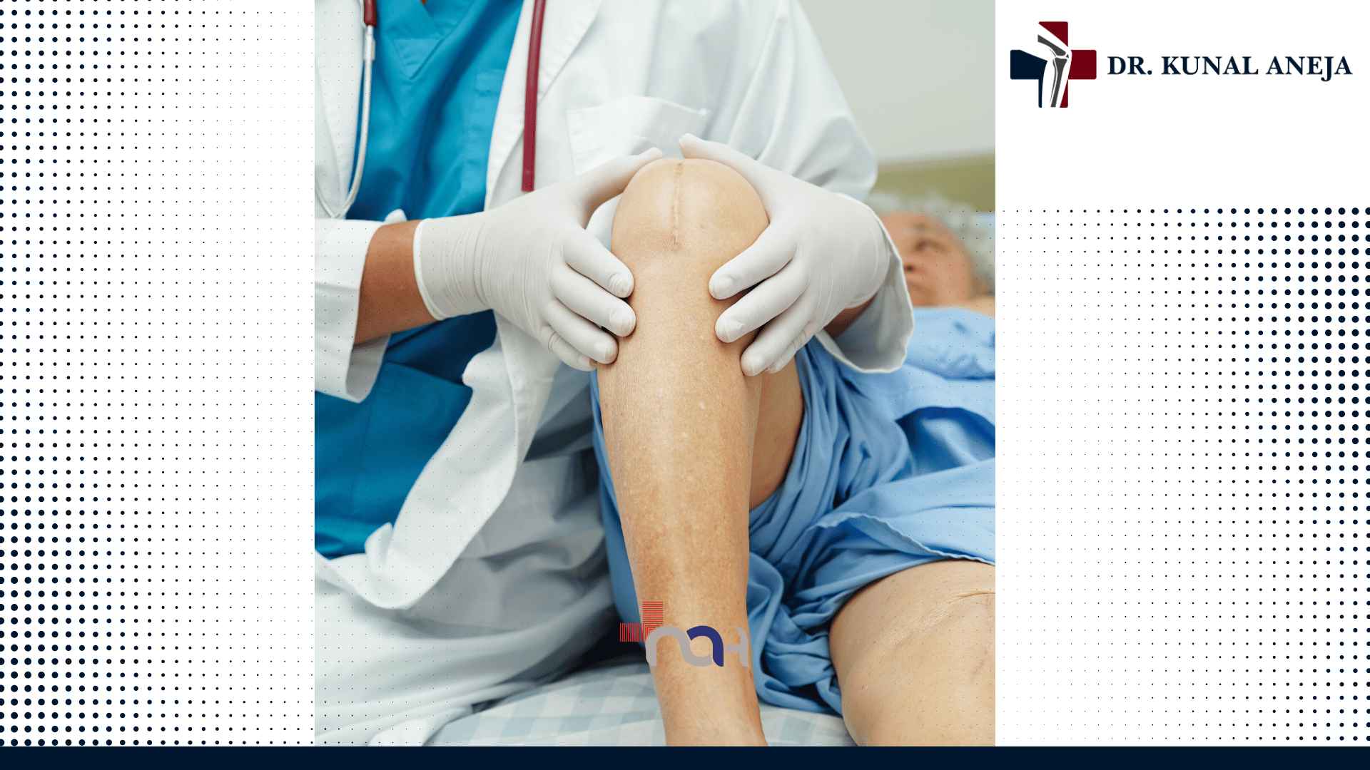 Total Knee Replacement in Delhi
