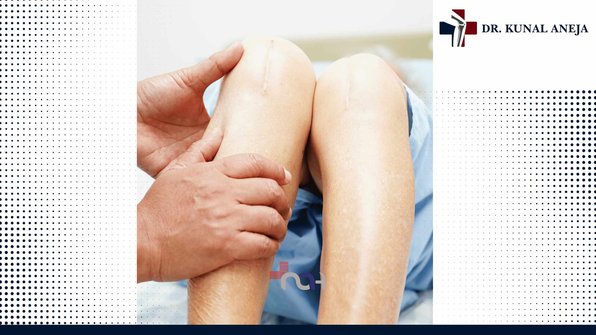 Best Knee Replacement Surgeon in Delhi