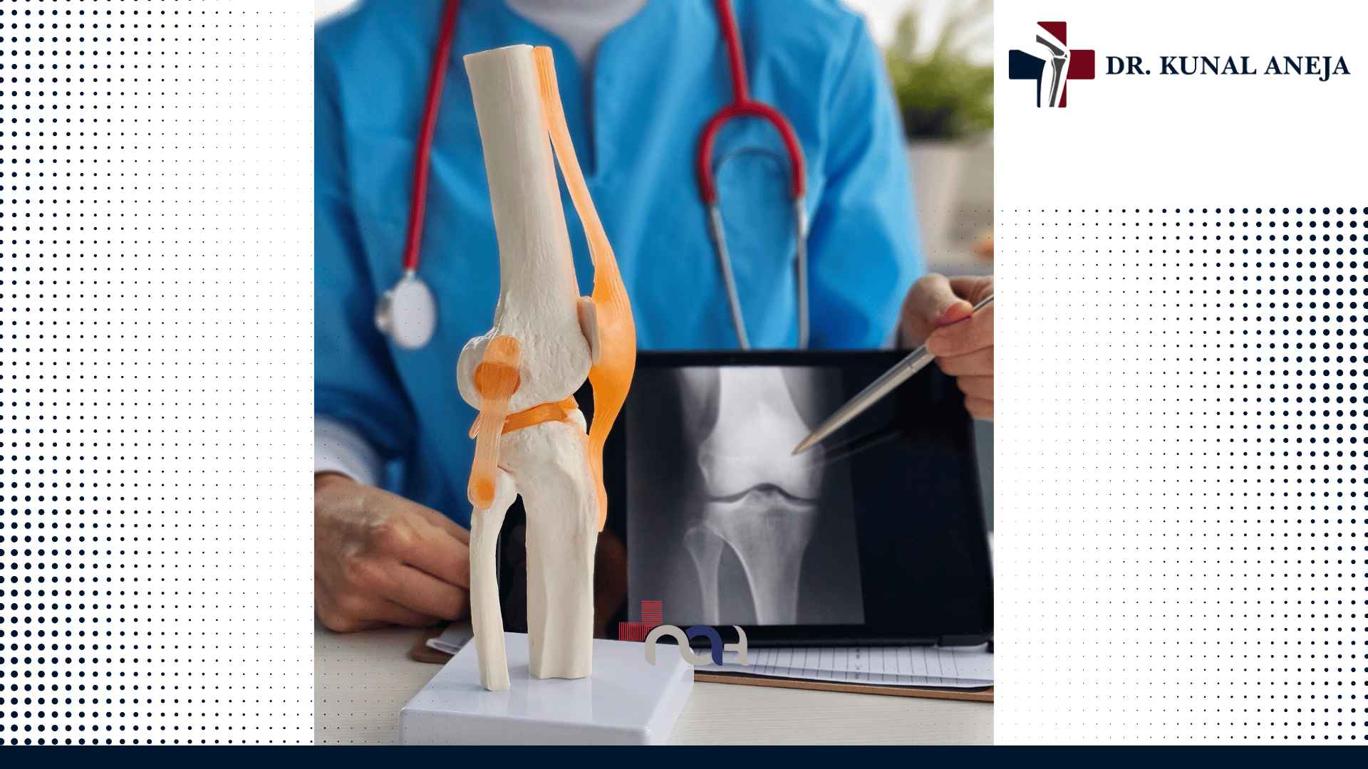 Robotic Knee Replacement Surgery in Delhi vs Traditional Method
