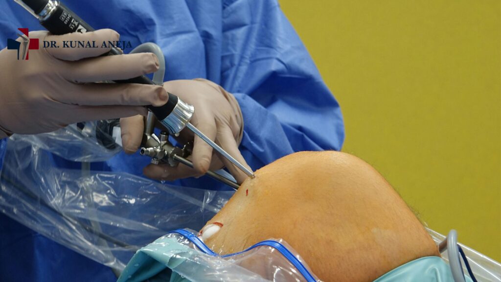 Robotic knee replacement surgery planning for improved implant precision