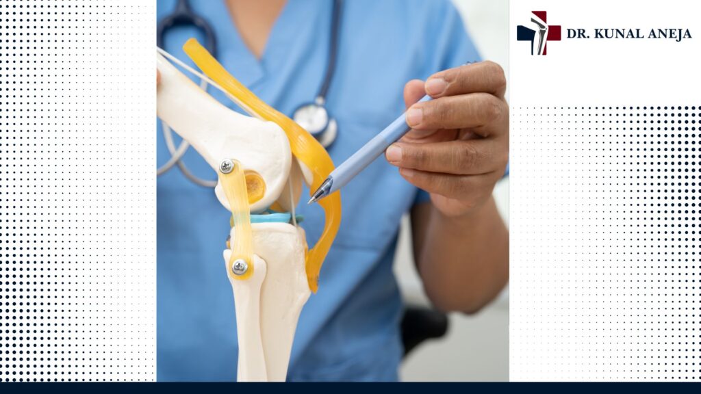 Best knee replacement surgeon in Delhi explaining knee implant options to a patient