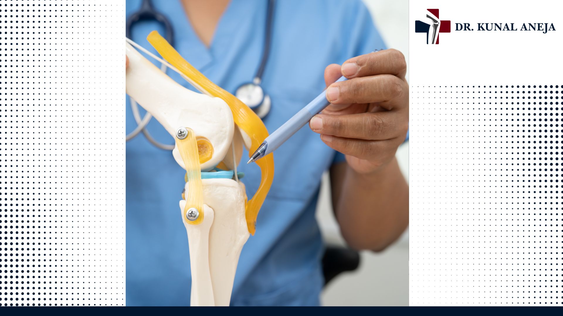Best knee replacement surgeon in Delhi explaining knee implant options to a patient