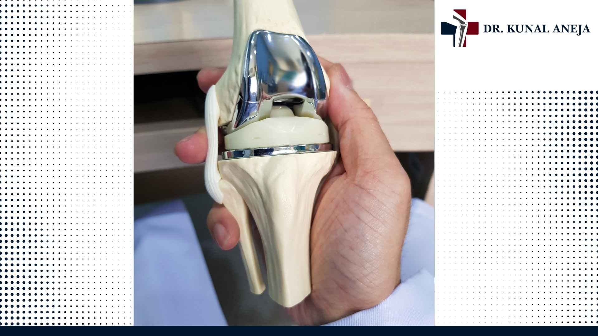 Robotic knee replacement surgeon consultation in India
