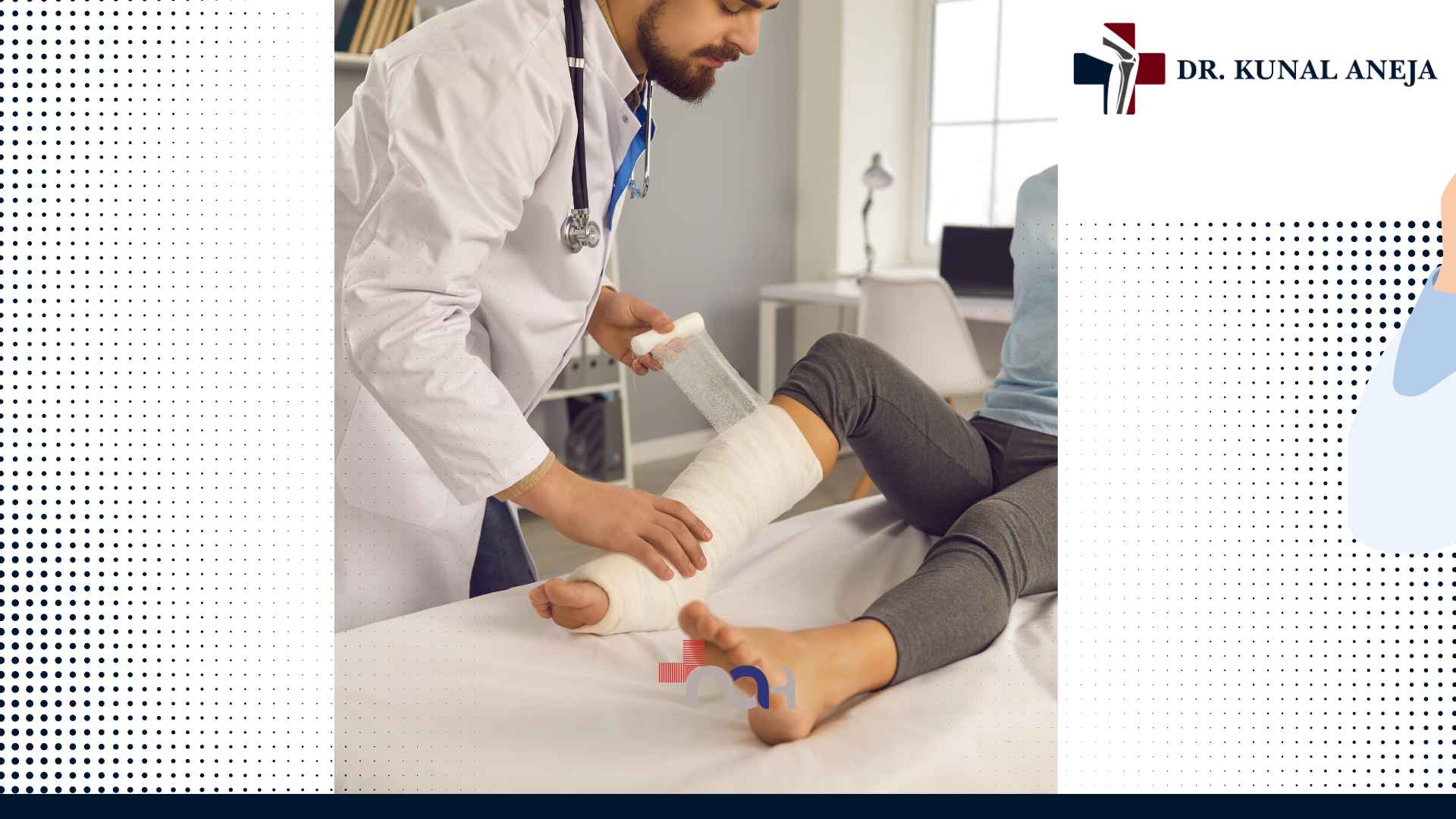 Fracture treatment consultation with Dr Kunal Aneja in Delhi