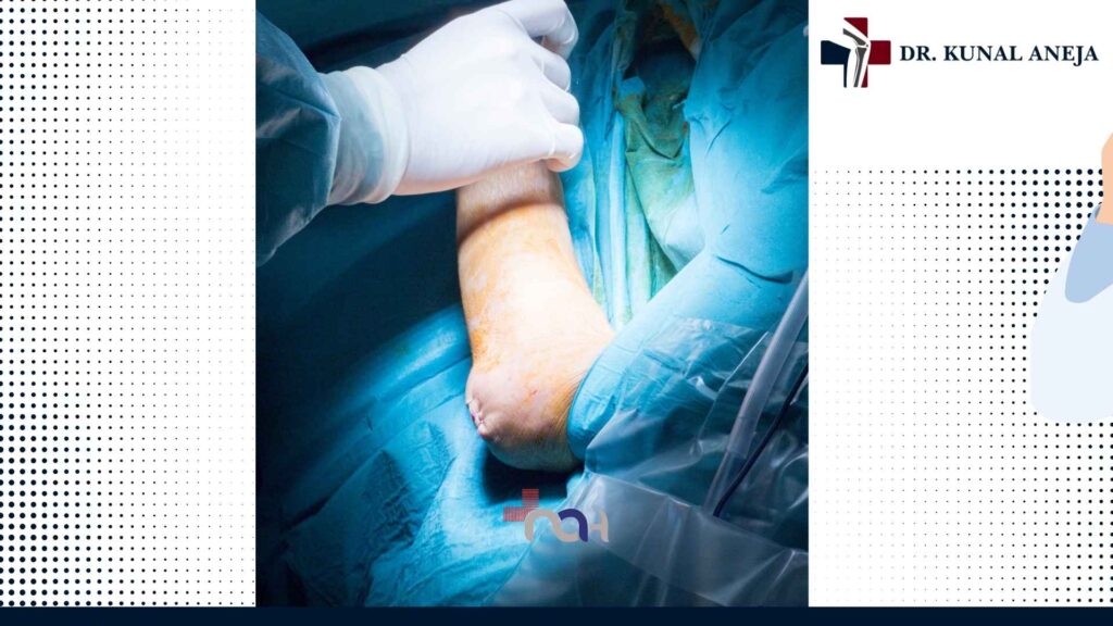 Elbow arthroscopy consultation with Dr Kunal Aneja in Delhi