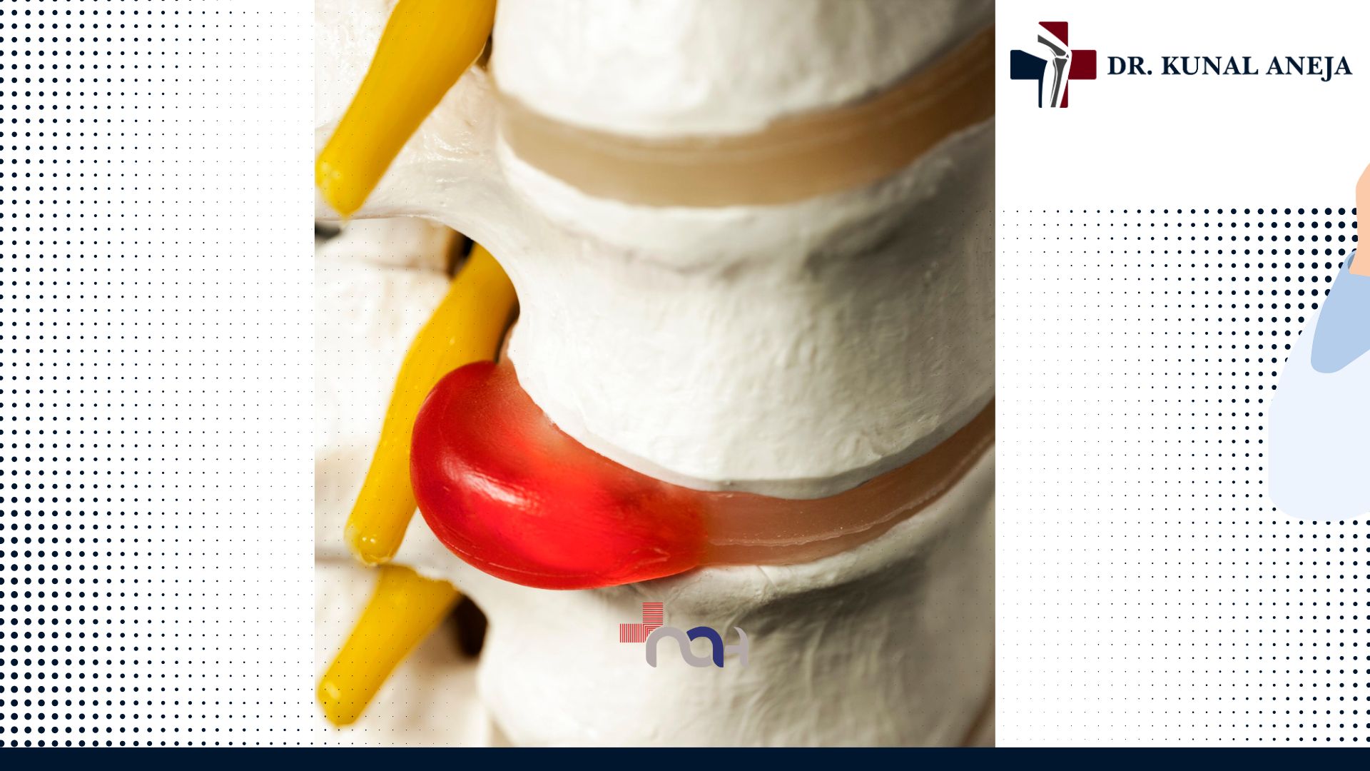 Slipped disc consultation at Naveda Healthcare Centre in Delhi