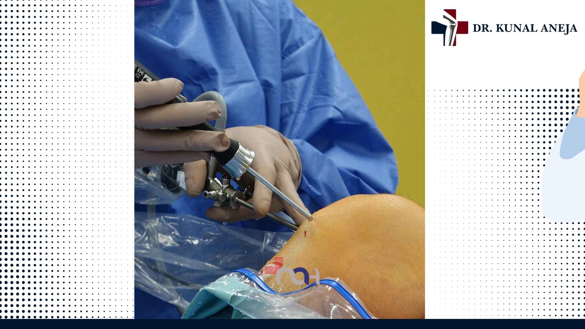 Consultation with Dr. Kunal Aneja, ACL surgeon in Delhi