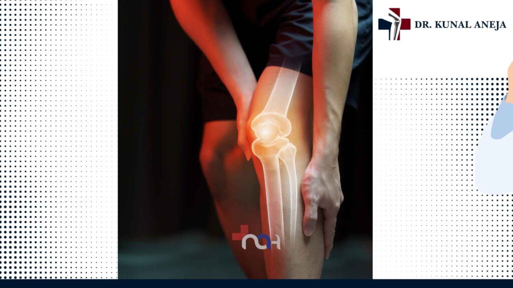 Consultation with Dr. Kunal Aneja, joint replacement surgeon near Rohini