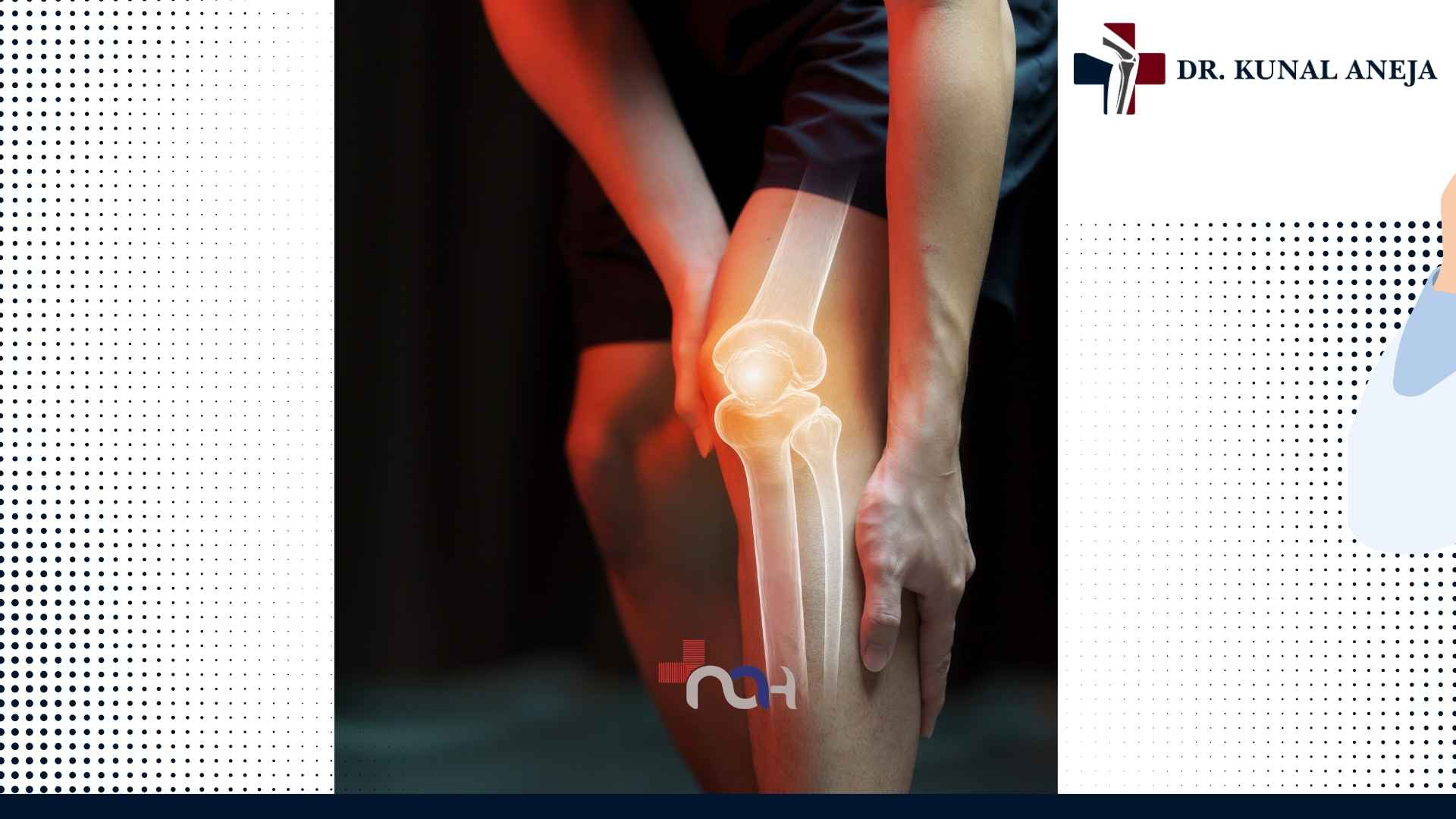 Consultation with Dr. Kunal Aneja, joint replacement surgeon near Rohini