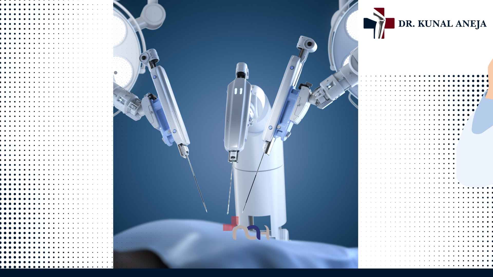 Robotic knee replacement technology being used during surgery planning