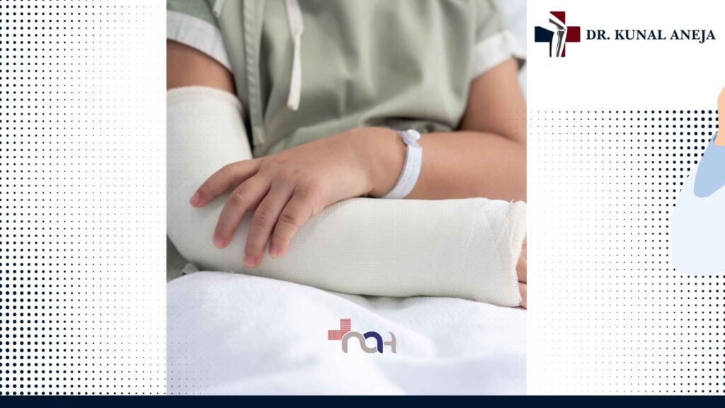 X-ray review for fracture treatment in Delhi