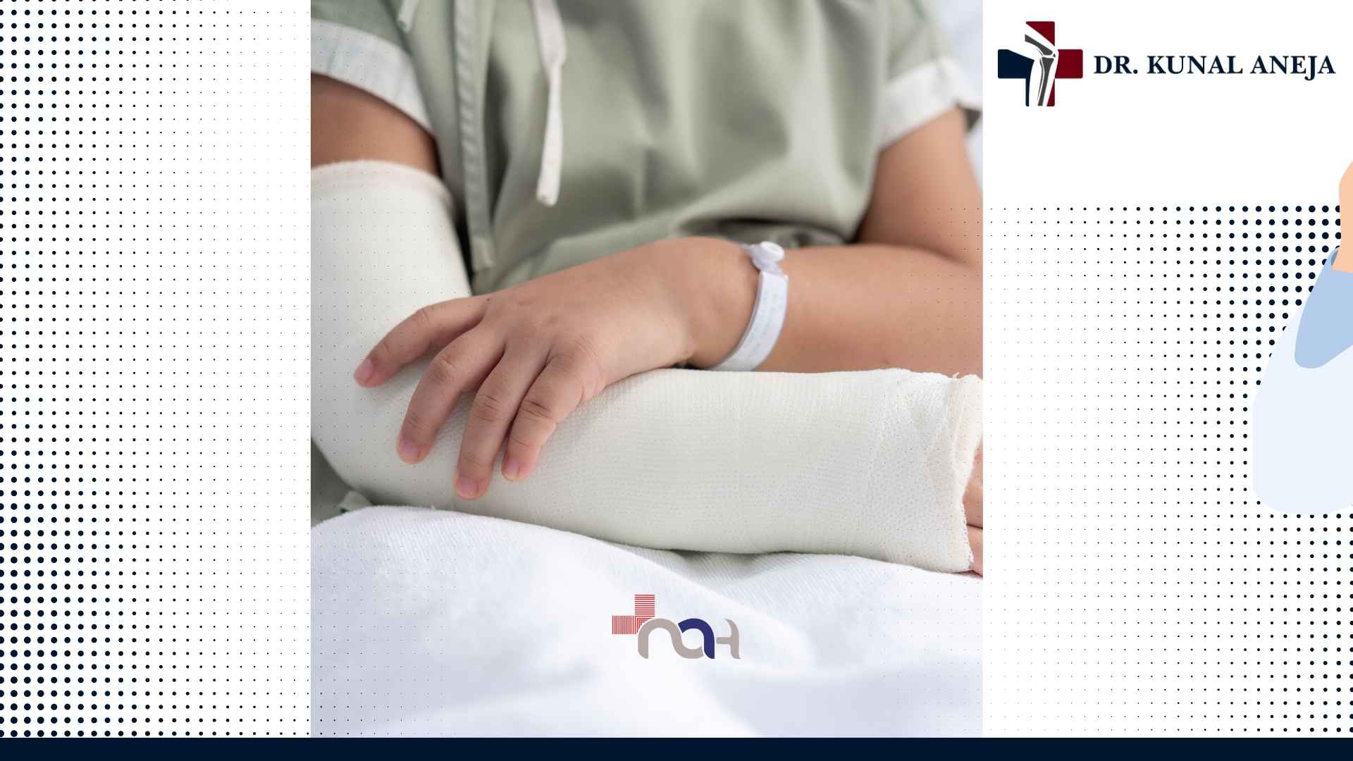 X-ray review for fracture treatment in Delhi