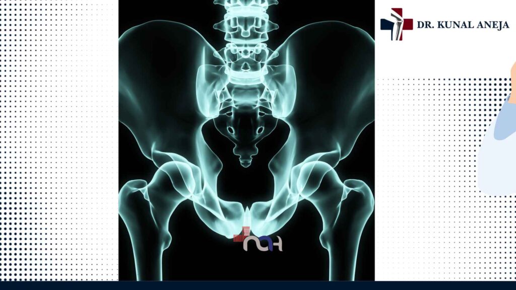 Hip preservation surgery to save your natural hip in Delhi