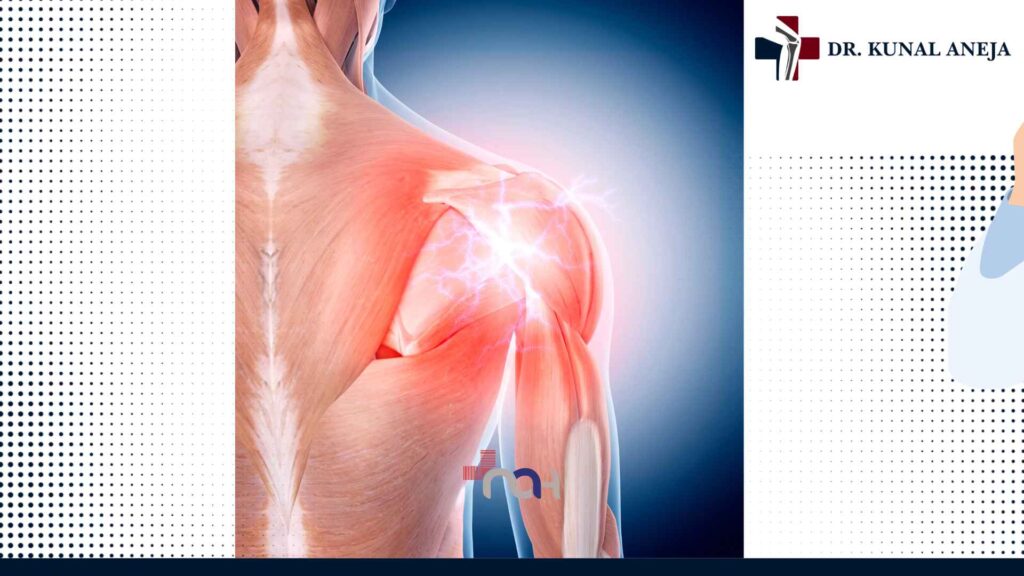Shoulder arthroscopy keyhole surgery in Delhi